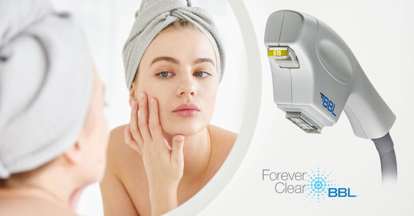Forever Clear® BBL treatment