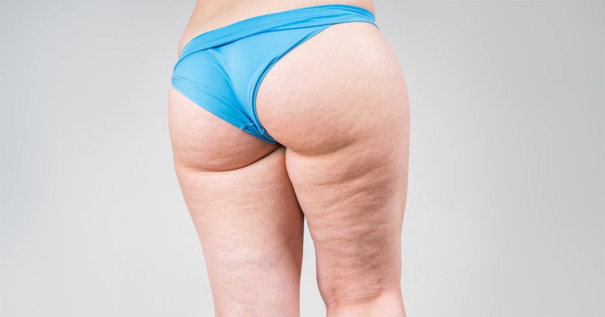 Discover how EndyMed smooths stubborn cellulite with deep energy technology