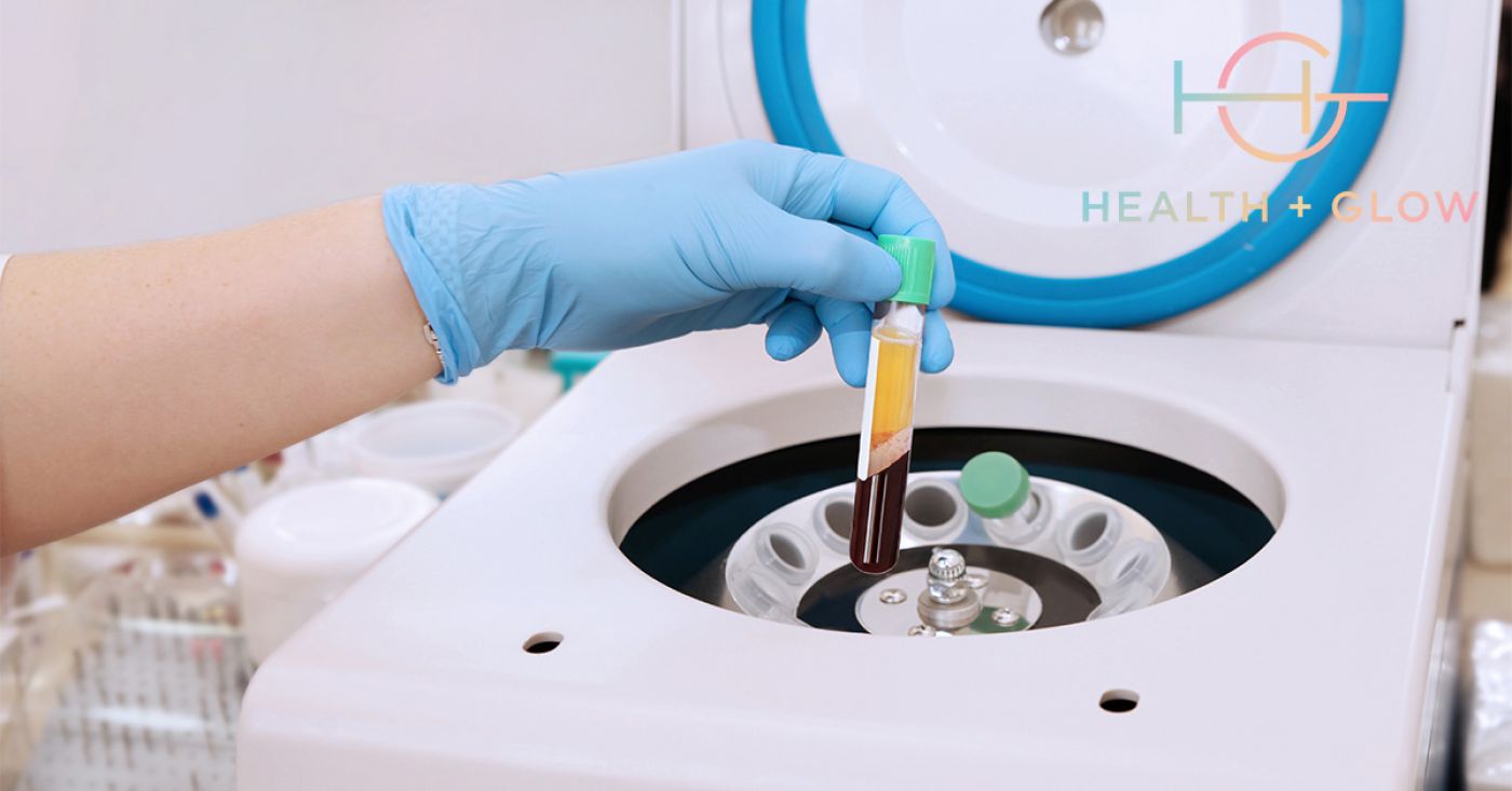 platelet rich fibrin treatment.